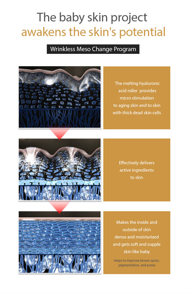 [MAXCLINIC] Wrinkless Meso Change Program